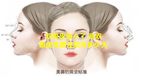 双眼皮割小了 割双眼皮需要住院吗多少天